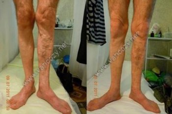 ��� ����� ������ 䳺!